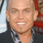 Martin Klebba