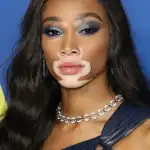 Winnie Harlow